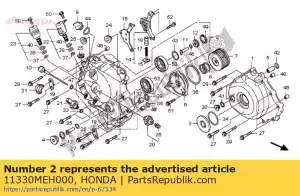 Honda 11330MEH000 cubierta de montaje, r cran - Lado inferior