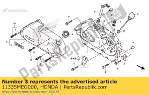 Honda 11335MEG000 cover comp., clutch - Bottom side