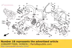 honda 22860MT7000 conjunto de cilindro., esclavo - Lado inferior